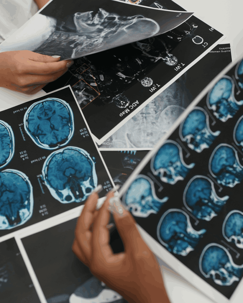 Clínicas de Neurocirujano Con Urgencias CDMX