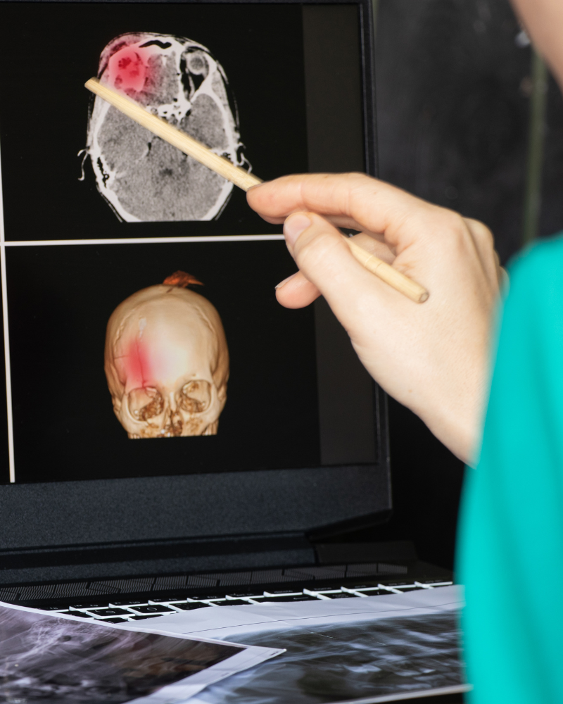 especialista-en-enfermedades-cerebrovasculares