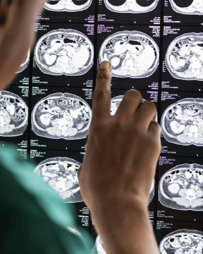 Neurocirujano Cerca De Mi Ubicación