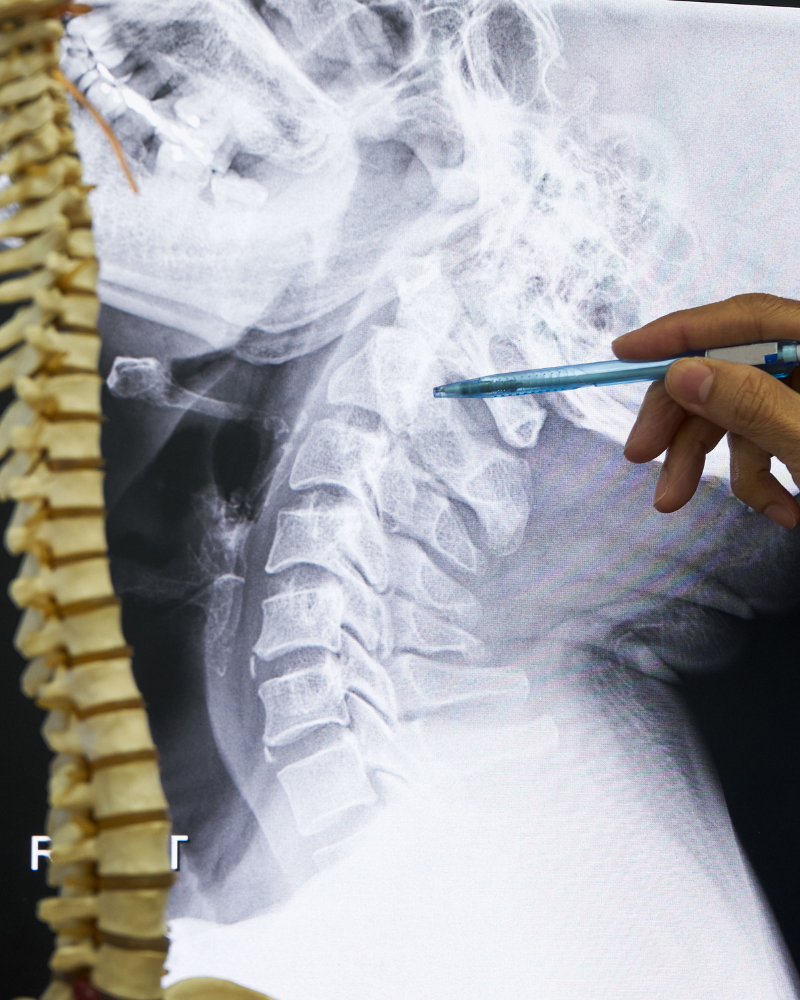 neurocirujano-especialista-en-columna