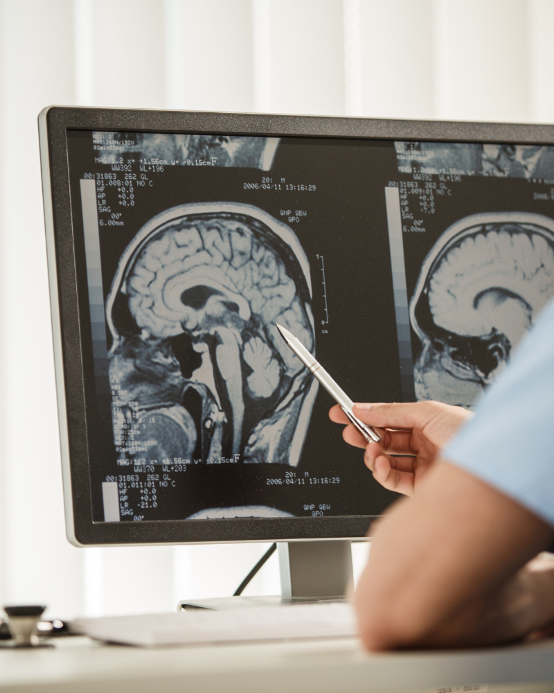 precio-cirujia-tumor-cerebra